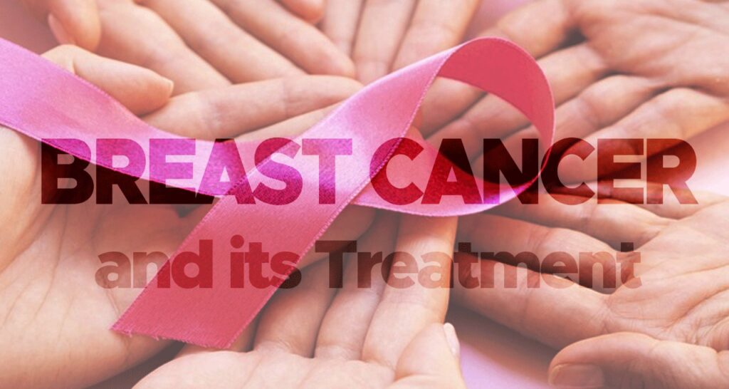Breast Cancer