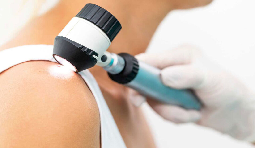 Skin Disease Warning