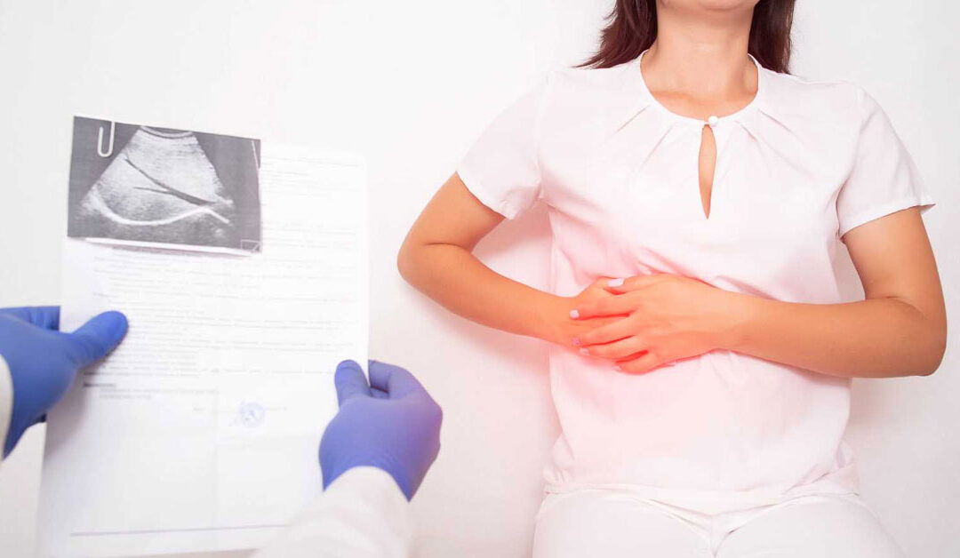 Bladder Cancer Prevention