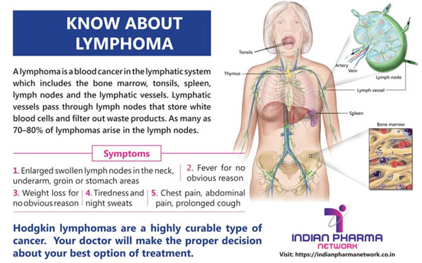 Know about lymphoma